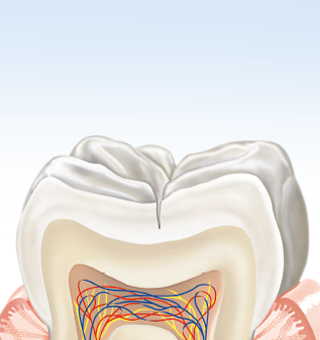 Karies entsteht nicht