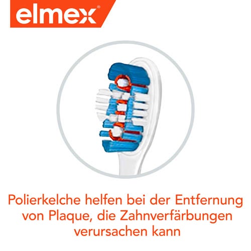 Polierkelche helfen Beläge zu entfernen